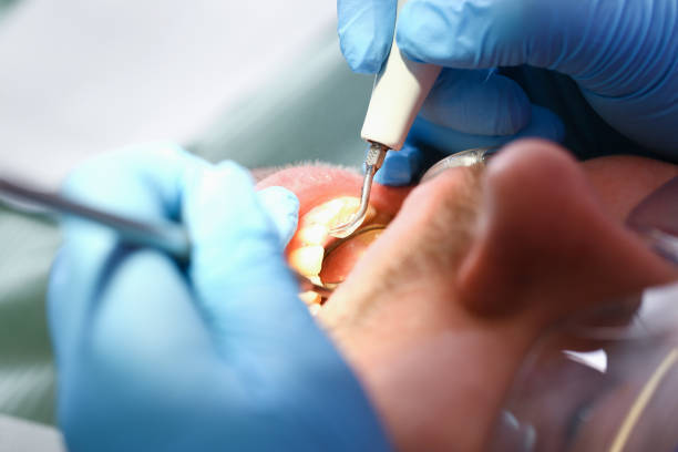 Best Emergency Denture Repair in Oil City, PA